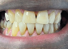 Before - Dentaliving