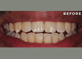 Before - Dentaliving