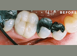 Before - Dentaliving