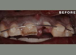 Before - Dentaliving