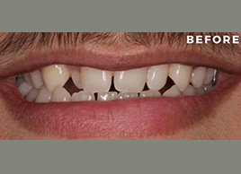 Before - Dentaliving