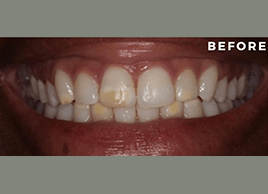 Before - Dentaliving