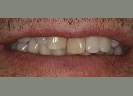 Before - Dentaliving